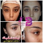 کلینیک پارسیان بیوتی
