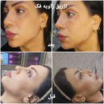 کلینیک زیبایی و لیزر مو گندم شرق تهران