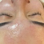 مرکز تخصصی پاکسازی پوست سیما عالینژاد