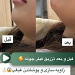 کلینیک زیبایی و مرکز لیزر رُز