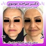 دکترمیراحدموسوی
