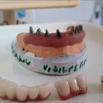 دندانپزشکی ایمپلنت و کلیه خدمات