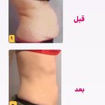 کلینیک تغذیه و رژیم درمانی و تناسب اندام (دکتر هانیه روانبخش)