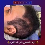 اولین مرکز میکرواسکالپ مشهد تاپ اسکالپ