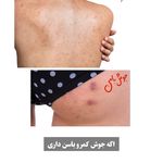 فیشال و خدمات پاکسازی پوست  فاطمه انامی