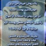 فشیال و اسکالپ زن روز