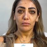 کلینیک زیبایی شایلی