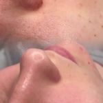 خدمات تخصصی پاکسازی پوست و فیشیال مهشید