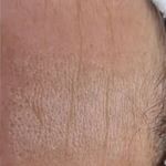 خدمات تخصصی پاکسازی پوست و فیشیال مهشید