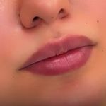 کلینیک زیبایی دکتر شمس(تخفیف ویژه)