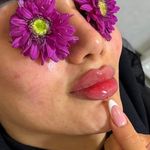 خانه لیزر فیلر و بوتاکس ثنا