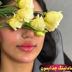 خانه لیزر فیلر و بوتاکس ثنا