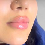 خانه لیزر فیلر و بوتاکس ثنا