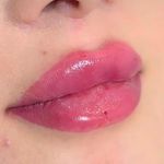 خانه لیزر فیلر و بوتاکس ثنا