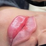 خانه لیزر فیلر و بوتاکس ثنا