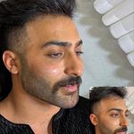 خانه لیزر فیلر و بوتاکس ثنا