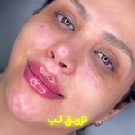 کلینیک زیبایی دکتر مرجان نصیری نسب