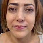 کلینیک زیبایی دکتر مرجان نصیری نسب