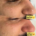 خدمات تخصصی پوست (فیشیالیست رویا صالحی)