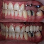دنداپزشکی دکتر یاشار معزز