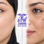 مرکز پی آر پی تهران