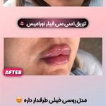 کلینیک پوست و مو و لیزر نیلوفر آبی