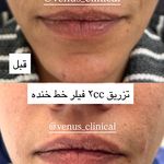 کلینیک پوست مو لیزر ونوس