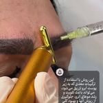 مطب پوست، مو و زیبایی و لیزر شبیرا
