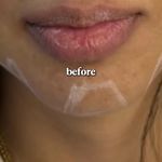 مطب پوست، مو و زیبایی و لیزر شبیرا
