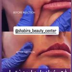 مطب پوست، مو و زیبایی و لیزر شبیرا