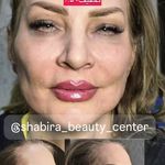 مطب پوست، مو و زیبایی و لیزر شبیرا