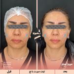 مرکز پزشکی و زیبایی میروژ سنتر