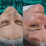 فیشال تخصصی سوزان