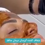 فیشال تخصصی سوزان