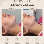 مرکز لیزر ،پوست و زیبایی کندی بیوتی