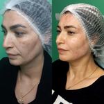 کلینیک زیبایی پارسیان آلفا