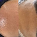 فیشال و خدمات پاکسازی پوست  فاطمه انامی