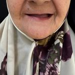 لابراتوار دندانسازی شید