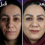 کلینیک زیبایی الماس کاملا اقساطی