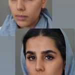 کلینیک زیبایی پوست و لیزر آلن