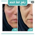 کلینیک لیزر و زیبایی لیلیا