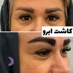 کلینیک زیبایی پوست و مو و لیزر پامچال