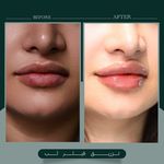 کلینیک زیبایی یوتوپیا