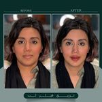 کلینیک زیبایی یوتوپیا