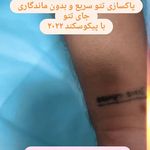 کلینیک لیزر موهای زائد(کلینیک مهر بوکان)