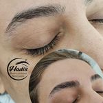 خدمات تخصصی ابرو حدیث معصومی