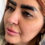 مطب پوست،مو ، زیبایی ولیزر