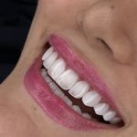 دندانپزشکی زیبایی جذاب