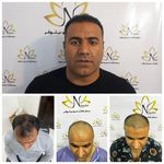 مرکز کاشت مو نیلوفر ( اندیمشک و دزفول )