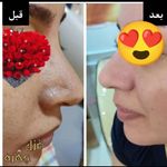 سالن زیبایی غزل چهره